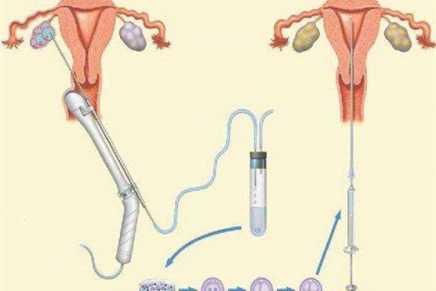 备孕一年了还没怀孕怎么回事